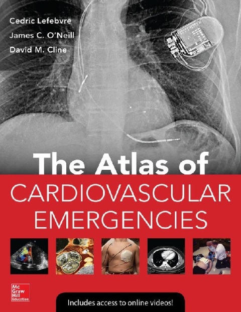 Atlas of Cardiovascular Emergencies 1st Edition