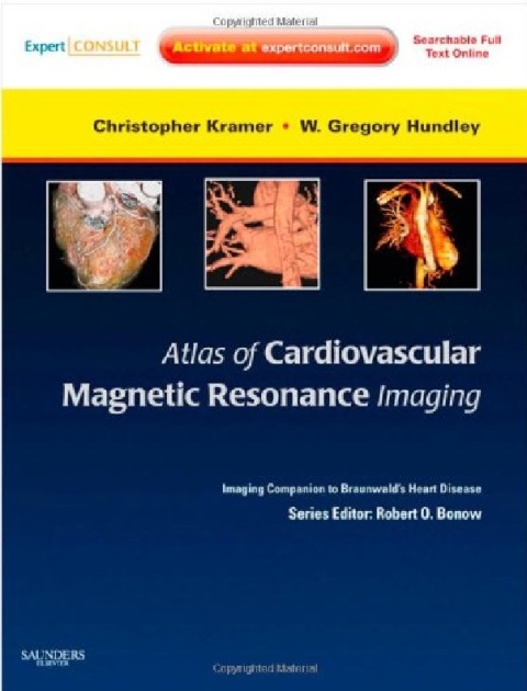 Atlas of Cardiovascular Magnetic Resonance Imaging